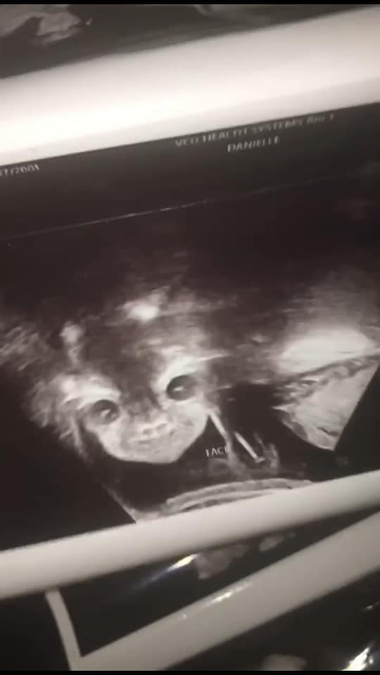 Devil Baby Sonogram