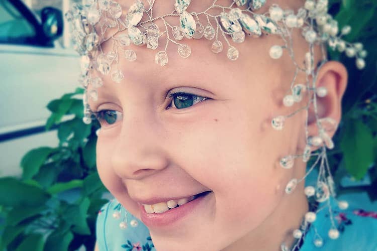 Gianessa Wride: Girl with Alopecia Wins Crazy Hair Day at School