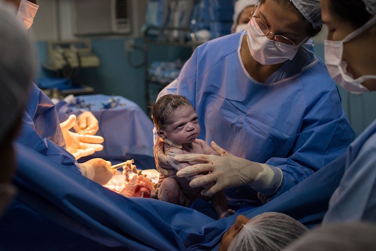 Newborn Baby Goes Viral After Serving Us the Ultimate Moody Staredown Literally Seconds After Joining the World