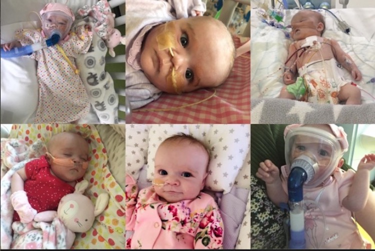 Baby Survives Heart Surgery, Catches Coronavirus While Recovering & Beats Virus Too