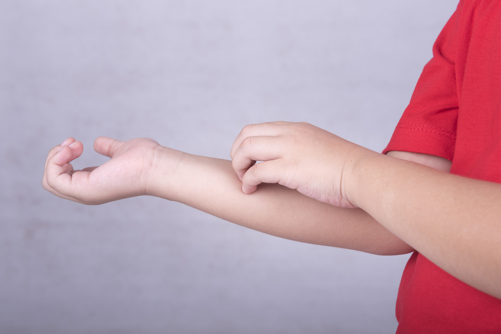 Expert Advice for a Mom Whose 2-Year-Old Son Recently Developed a Skin Allergy