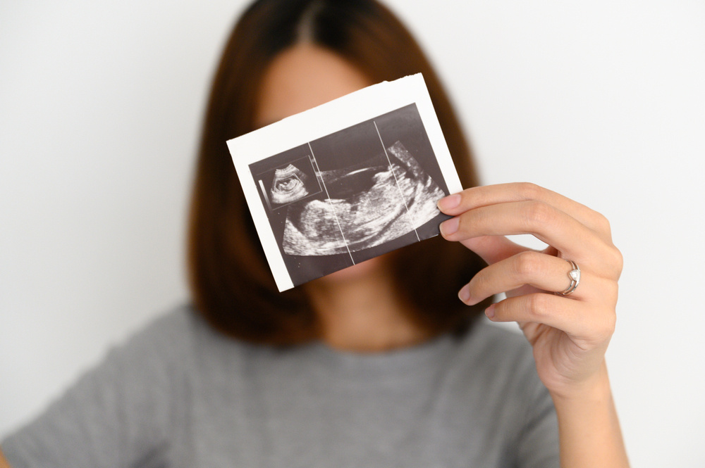 I'm Going to Be a First-Time Mom: When Should I Have My First Ultrasound?