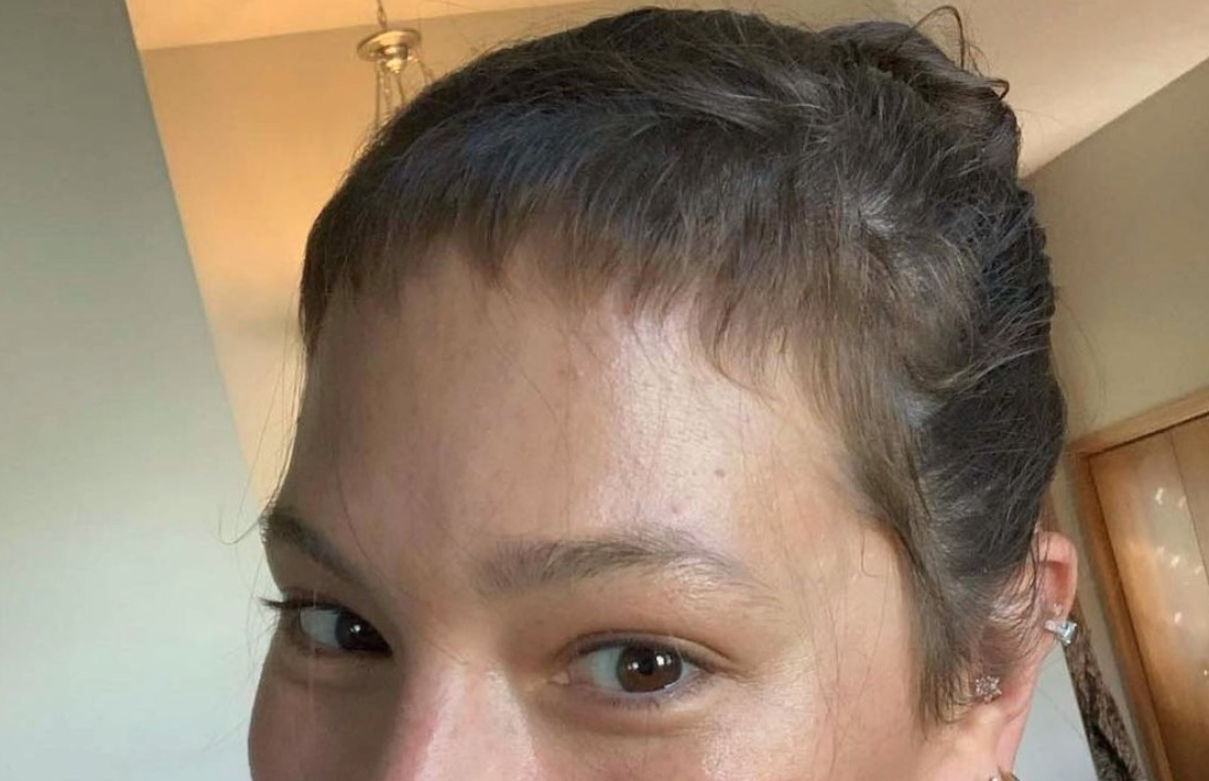 Ashley Graham's Hair Loss 4 Month Postpartum Traumatized Her