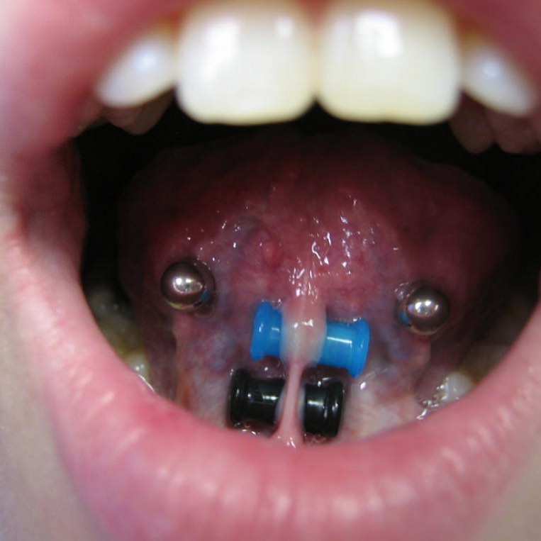 30 Extreme Piercings That Will Make Your Teeth Hurt