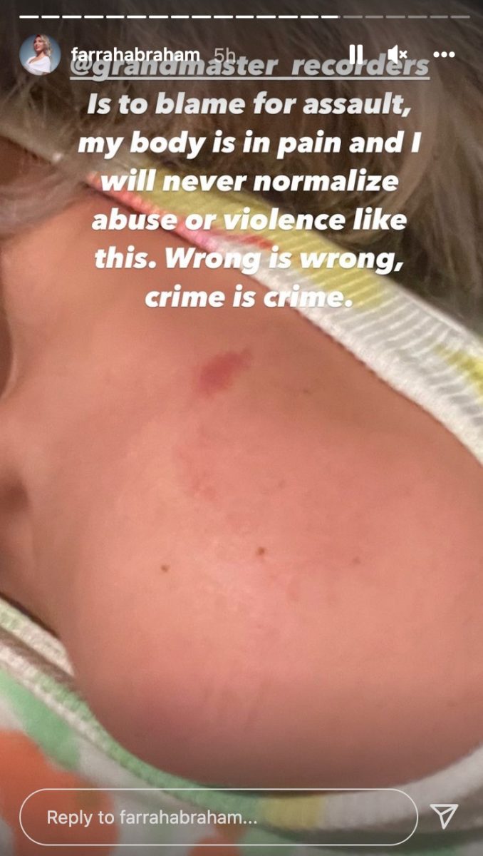 Farrah Abraham Shares Photos of Her Body After Citizen Arrest Outside New Popular Hollywood Restaurant