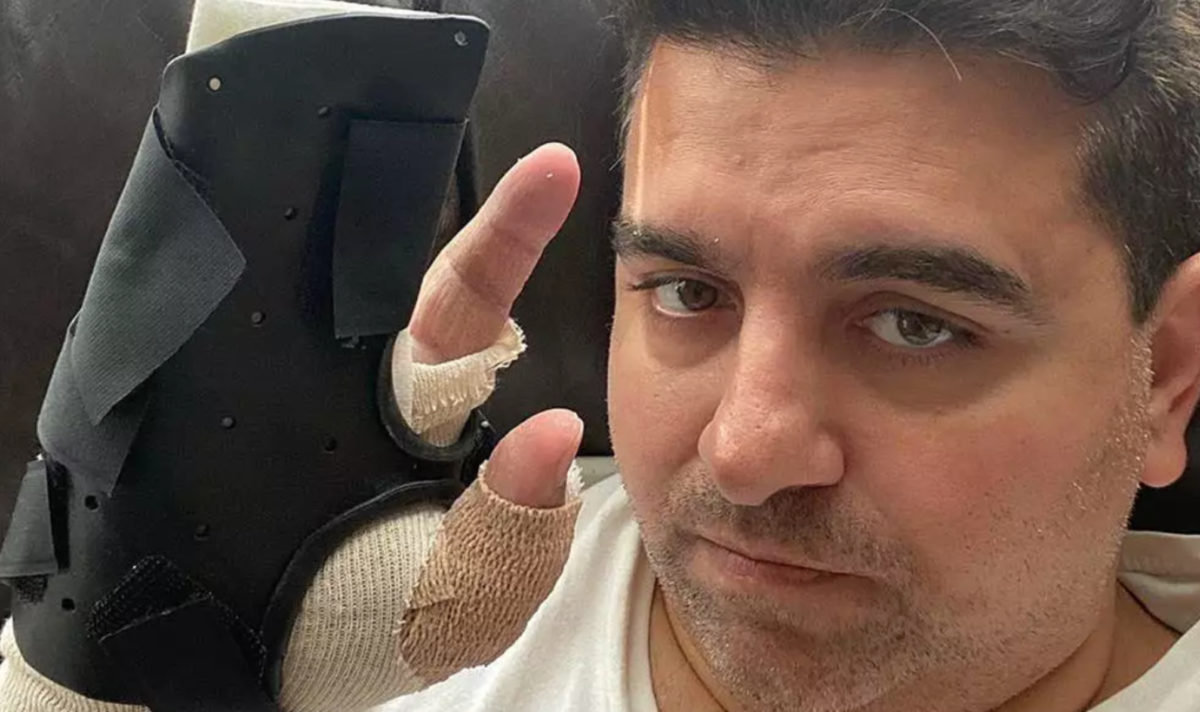 Buddy Valastro's 5th Hand Surgery Is Not His Final One But The Prognosis Is Good